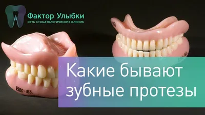 Съемные зубные протезы: какие лучше, виды, преимущества, методы  протезирования, особенности