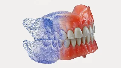 Съемные зубные протезы в Киеве 🦷 Цены на съемные протезы Дарница |  iStomatolog