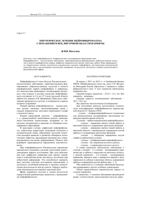 Как сегодня диагностируют нейрофиброматоз 2 типа и шванноматоз? | Помощь  редким | Дзен