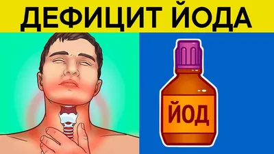 Дефицит йода: симптомы и профилактика