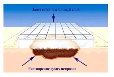 Система очищения ран CareMaster E купить, цена