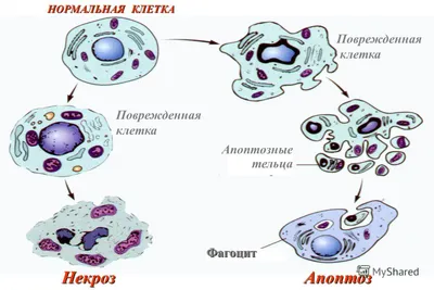 Некроз фото