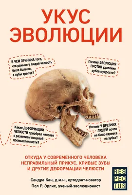 Исправление дистального прикуса. Дылки больше нет | Пикабу