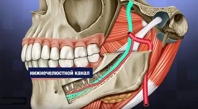 Современные методы удаления нерва из зуба - блог «ДИНАСТИЯ»