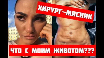 Абдоминопластика в Москве - консультация 0 руб!