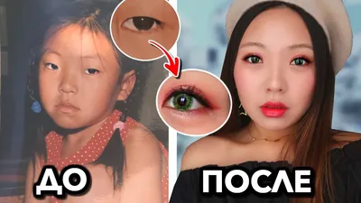 Как избавиться от мешков под глазами и нависших век Major Beauty