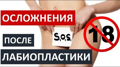 ❗️🔞ОСЛОЖНЕНИЯ ПОСЛЕ ЛАБИОПЛАСТИКИ ❗️🔞ТОЛЬКО 18+ - YouTube