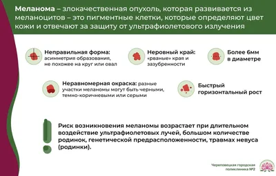 Как отличить родинку от меланомы и можно ли удалять родинки на коже - 30  мая 2023 - 74.ru