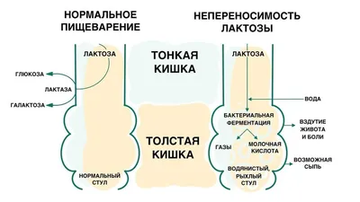 Цвет детского стула: как понять, что норма, а что нет - Статьи о детском  питании от педиатров и экспертов МАМАКО