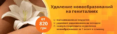 Кондилома: лечение, симптомы, виды, профилактика, причины и последствия  заболевания