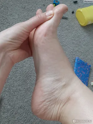 Почему слезает кожа между пальцами ног: причины и способы лечения