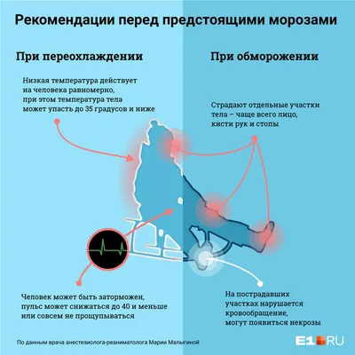 обморожение Стоковых иллюстраций и клипартов – (1,383 Стоковых иллюстраций)