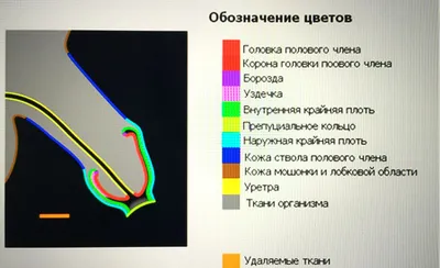 Да начнется казахский срач часть 5 Сундетке отыргызу (обрезание) | Пикабу