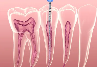 Зубная паста Sensodyne Ежедневная защита для чувствительных зубов Морозная  мята - «Sensodyne \"Морозная мята\"-Бюджетное решение проблемы чувствительных  зубов» | отзывы