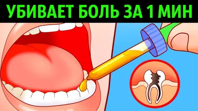 Почему так больно бывает обтачивать зубы и что делать | Альянс  бьюти-ортопедов, Москва