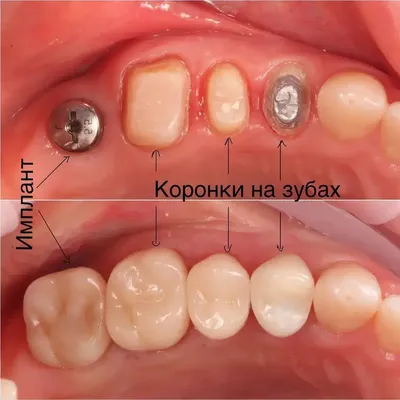 Мчедлишвили Илья Омарович | 101 Стоматолог