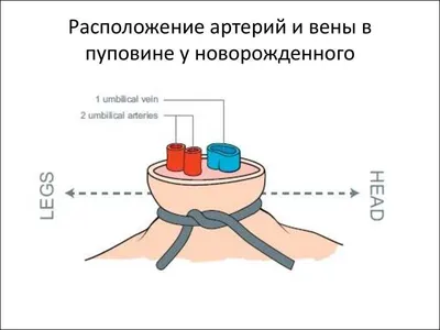 Омфалит у взрослых лечение консультация в экспертной клинике ID-CLINIC  Санкт-Петербург