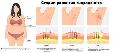 Новое тело: семь монологов о раке груди — Гласная