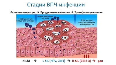 Вирус папилломы человека. Так ли безобидны бородавки?