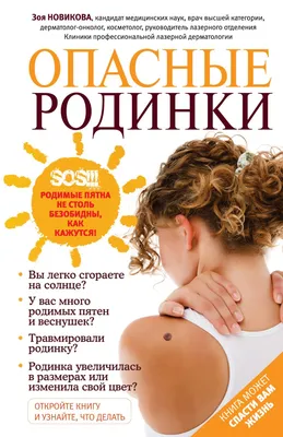 Родинки и папилломы на коже: как различить, почему они появились и как их  можно безопасно удалить и избежать перерождения