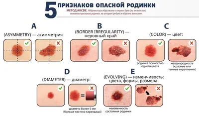 Книга Опасные Родинки - купить спорта, красоты и здоровья в  интернет-магазинах, цены на Мегамаркет | 165587