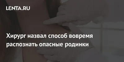 Как вовремя распознать опасные родинки? | МЦ Промедклиник