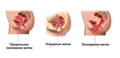 Лабиопластика в Вологде | Цены на интимную пластику половых губ в Клинике  «Константа»