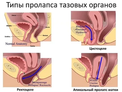 Восстановление после родов: как может помочь пластический хирург