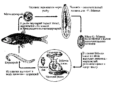 Описторхоз: что это, симптомы, признаки у взрослых, диагностика, сколько  стоит лечение