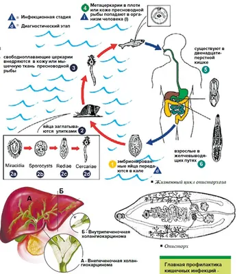 Описторхоз | Все о печени | Дзен