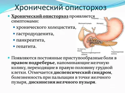 Хронический описторхоз: симптомы, признаки, лечение, диагностика