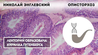 Описторхоз: что это, симптомы, признаки у взрослых, диагностика, сколько  стоит лечение