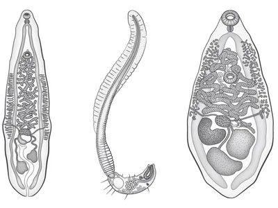 Русские народные черви: Описторхоз. | Пикабу