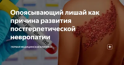 Герпес — симптомы и лечение | Блог Daily Medical