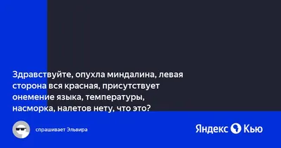 Удаление миндалин (хирургический метод) - «Тонзиллэктомия проблемных  миндалин под общим эндотрахеальным наркозом с зашиванием и прижиганием.  ОБНОВЛЕНИЕ СПУСТЯ 2 МЕСЯЦА» | отзывы