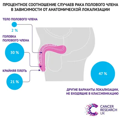 Баланит и баланопостит