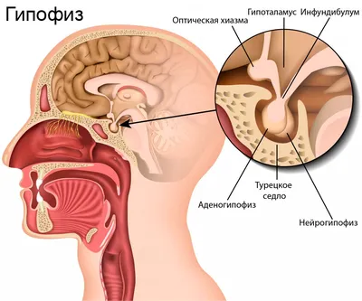 В Ростове женщине удалили 2-килограммовую опухоль шеи