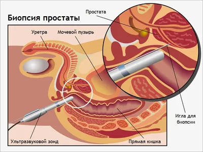 Меланома кожи: как выглядит, симптомы, причины, диагностика, лечение