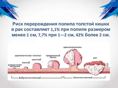 Геморрой - симптомы, лечение, причины и профилактика геморроя - Гармония