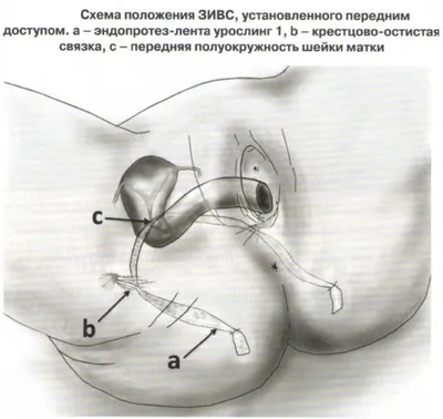 СИМПТОМЫ ОПУЩЕНИЯ ВНУТРЕННИХ ОРГАНОВ/ Как помочь себе при опущении  внутренних органов - YouTube