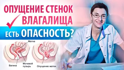 Что происходит с маткой после родов? Опущение стенок влагалища - опасно ли?  - YouTube