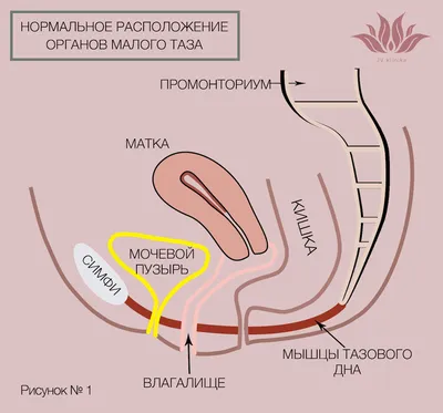 Опущение матки и возможности его лечения — JV klīnika