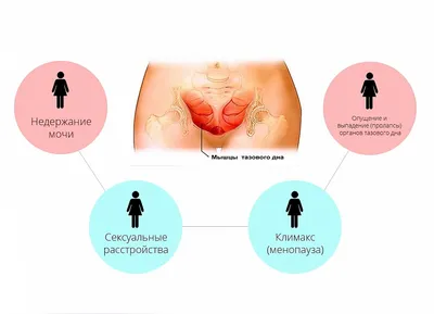 Признаки опущения и выпадения стенок влагалища Блог о врачах Хабаровска,  Неврологи, Педиатры, Психологи, Логопеды, Массажисты. Невродом