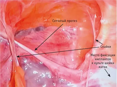 AMBULATOORNE OPERATSIOON