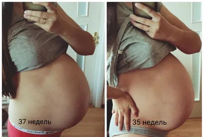 Опустился ли живот?Фотопуз 37 недель🤰 — 10 ответов | форум Babyblog