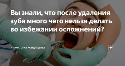 Удаление ретинированного зуба мудрости ультразвуком Piezosurgery