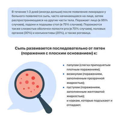 Долгая история оспы. Страшная болезнь поражала уже древних египтян | XX2  ВЕК | Дзен