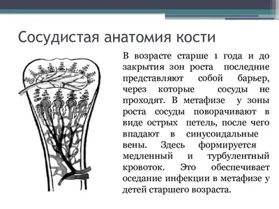 Остеомиелит это инфекция костей. Staphylococcus aureus наиболее  распространенный организм, наблюдаемый при остеомиелите Векторное  изображение ©Sakurra 531920854