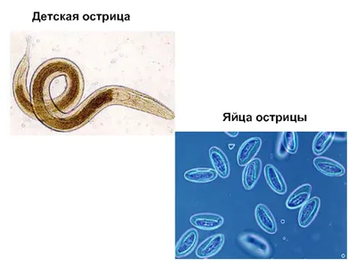 Острицы: какие признаки, что делать? | МедИнфо | Дзен