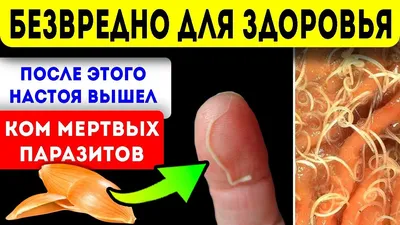 Паразиты у детей. Откуда и как с ними бороться